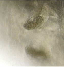 Phytomyza lappae larva,  anterior spiracles,  dorsal